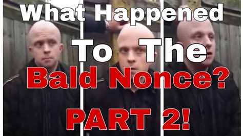 <strong>bald nonce what happened</strong>. . Bald nonce what happened